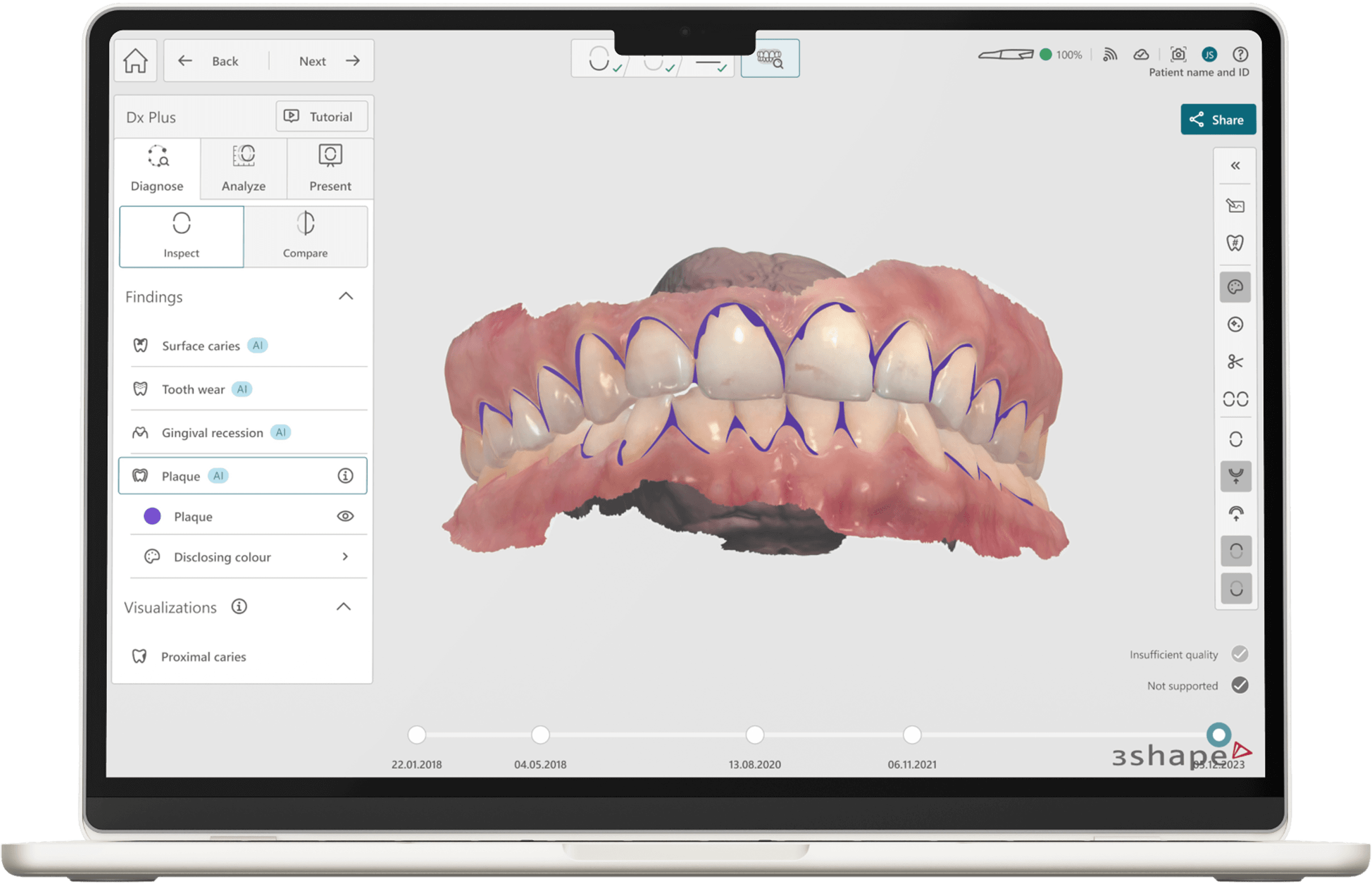 TRIOS Dx interface shown across multiple diagnostic workflow screens